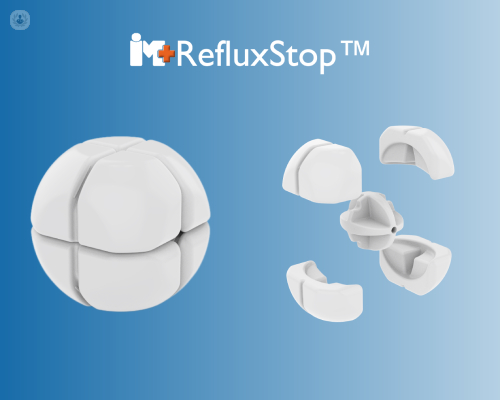 refluxstop®