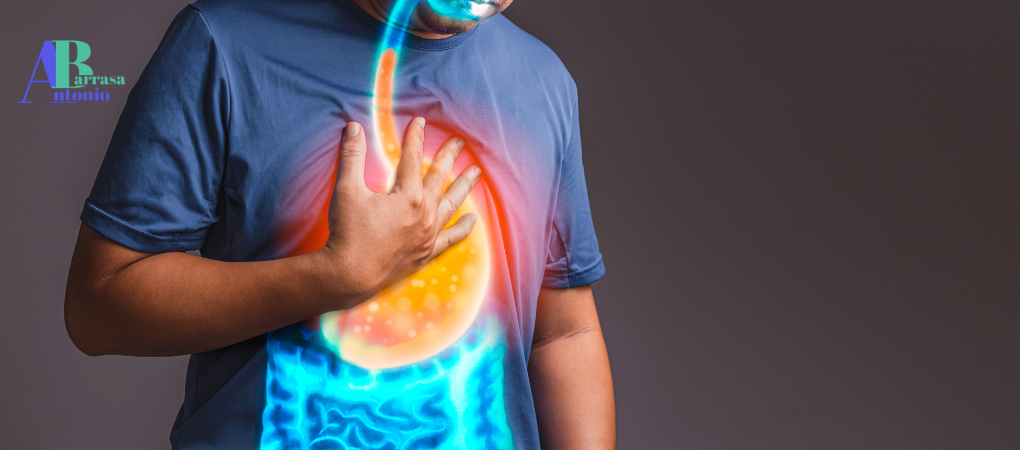 reflujo gastroesofágico